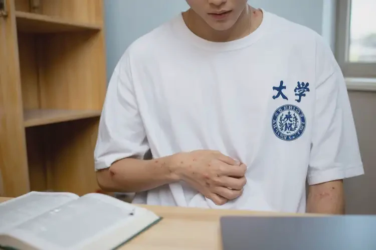 大学生肚子上经常起湿疹可不可以根治(图3)