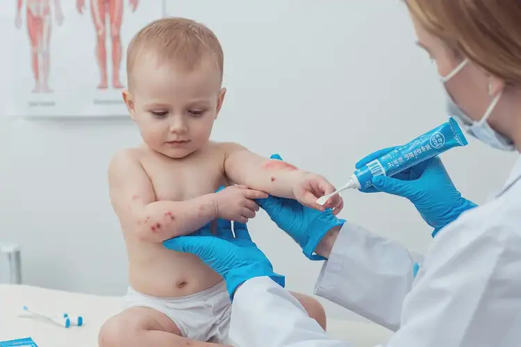 嬰兒手臂上經(jīng)常起濕疹可以治好嗎(圖3)