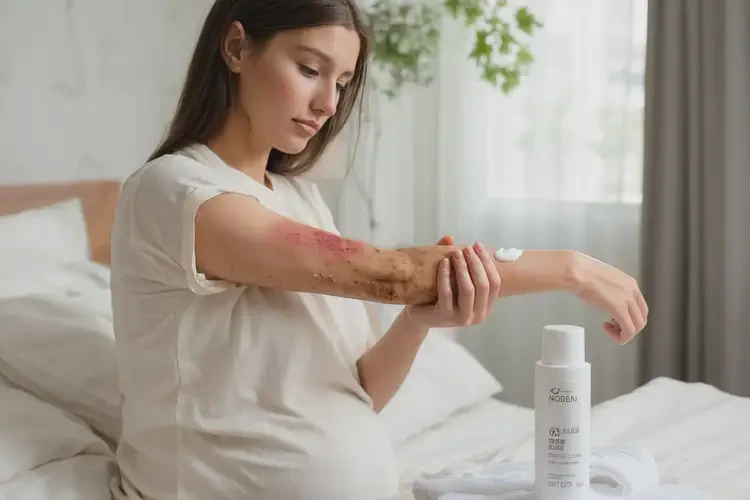 產(chǎn)婦手臂容易起濕疹可以治好嗎(圖3)