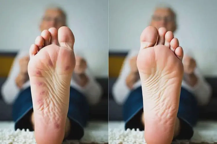 老年人腳上偶爾起濕疹可以治好嗎(圖4)