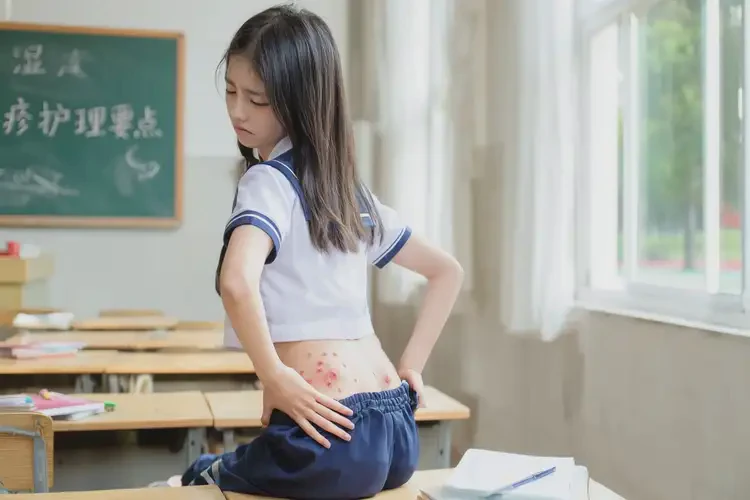 中學(xué)生屁股起濕疹可不可以根治(圖4)
