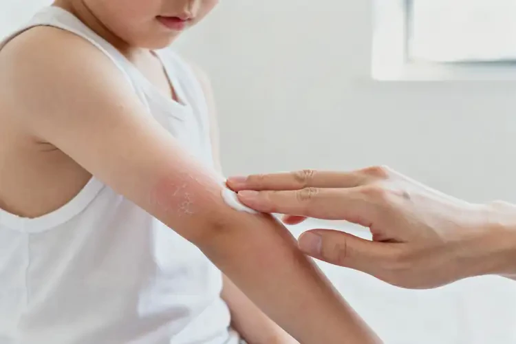 兒童手臂經(jīng)常起濕疹能靠自己自愈嗎(圖1)