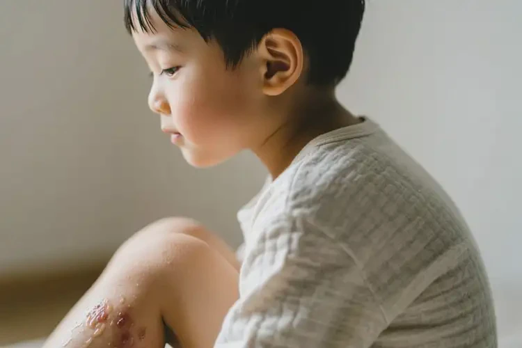 孩子全身偶爾起濕疹可以治好嗎(圖2)