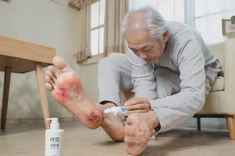 老年人腳上有濕疹可以治好嗎(圖2)
