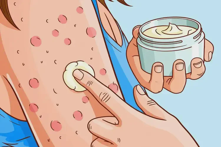 女生手臂上經(jīng)常長濕疹可以治好嗎(圖1)