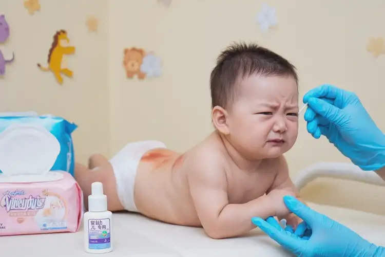 嬰幼兒肛周出現(xiàn)濕疹可以治好嗎(圖4)