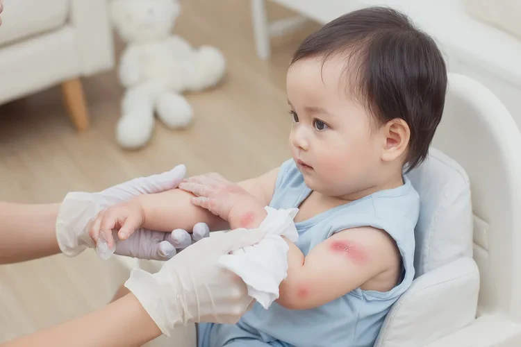 嬰兒手臂上出現(xiàn)濕疹可以治愈嗎(圖2)