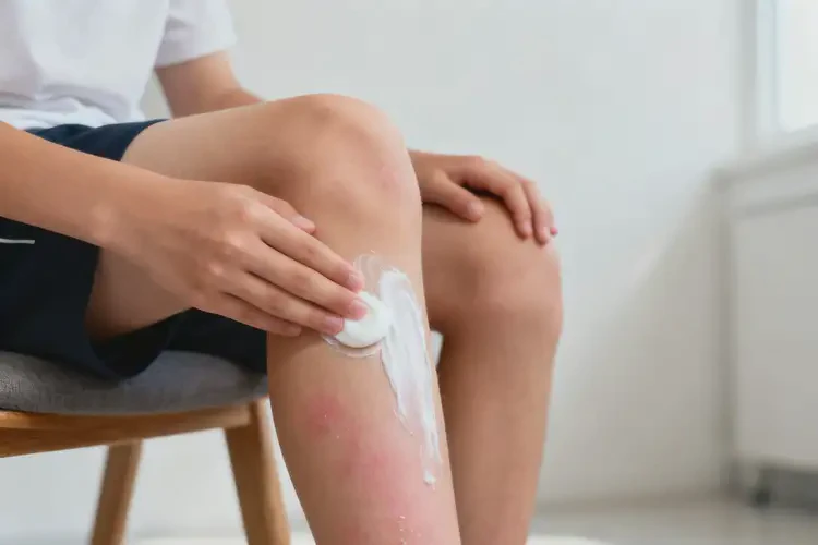 青少年小腿出現(xiàn)濕疹可不可以根治(圖1)