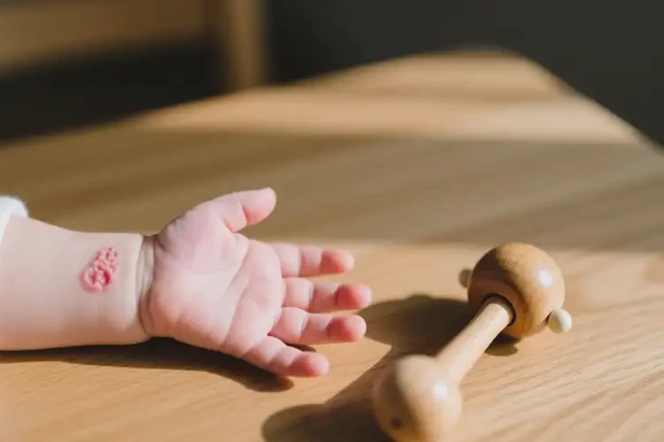 嬰兒手上偶爾起濕疹可以治好嗎(圖1)