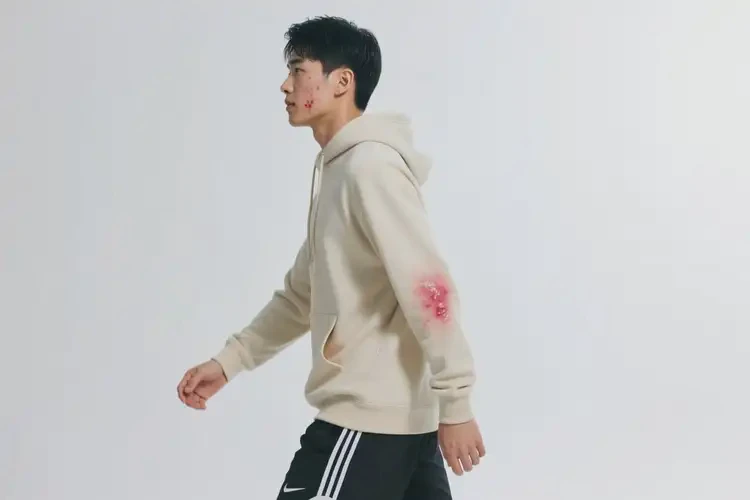 男生全身有濕疹可以治好嗎(圖1)