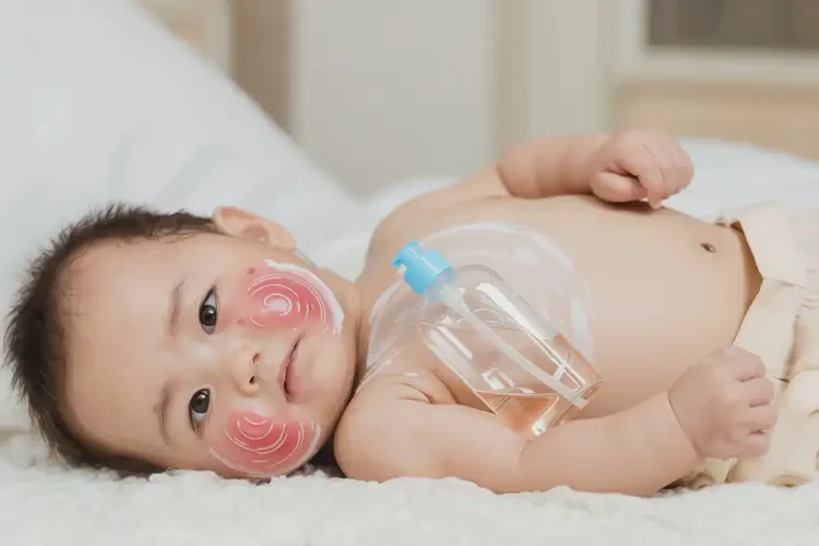 小孩肚子有濕疹不管它會(huì)自己自愈嗎(圖2)