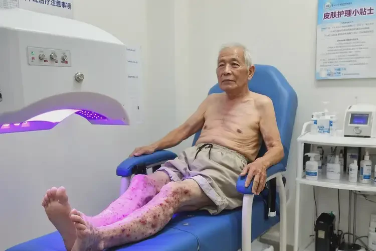 高齡老人小腿容易長濕疹可不可以根治(圖1)