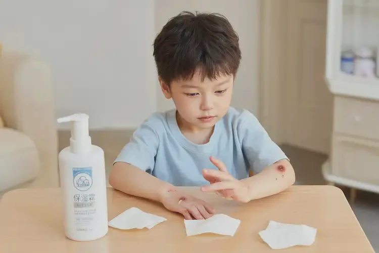 兒童手上偶爾長(zhǎng)濕疹可以治好嗎(圖2)