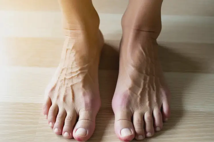 老人腳上偶爾起濕疹可以治好嗎(圖3)