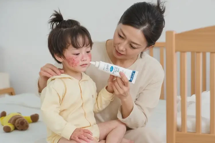 幼兒全身容易長濕疹可以徹底自愈嗎(圖3)