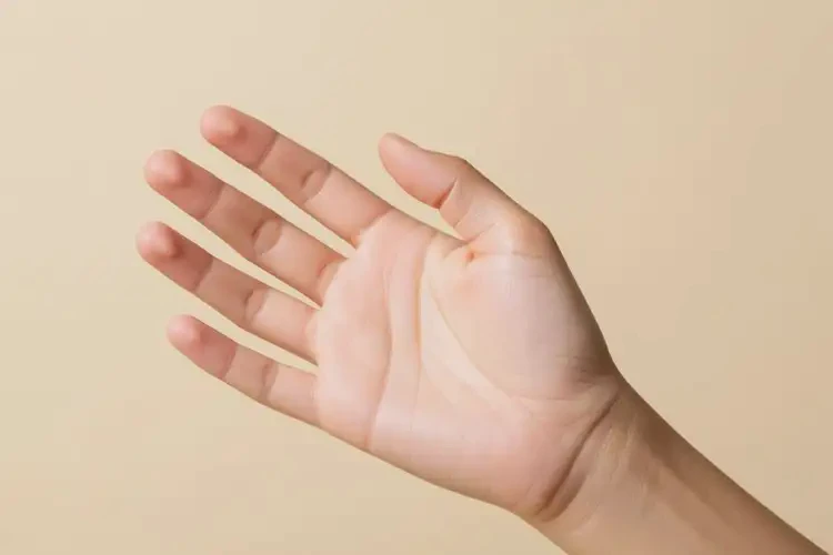 青少年手上容易長濕疹可不可以根治(圖4)