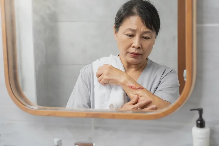 哺乳期妈妈屁股上容易起湿疹能靠自己自愈吗(图2)