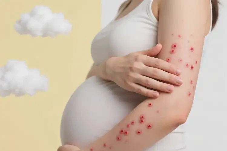 產(chǎn)婦手臂經(jīng)常起濕疹可以治好嗎(圖1)