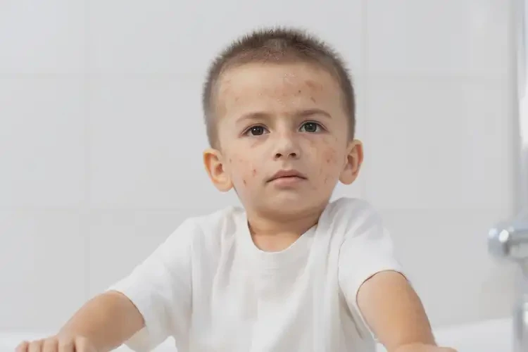 幼兒全身容易長濕疹可以徹底自愈嗎(圖4)