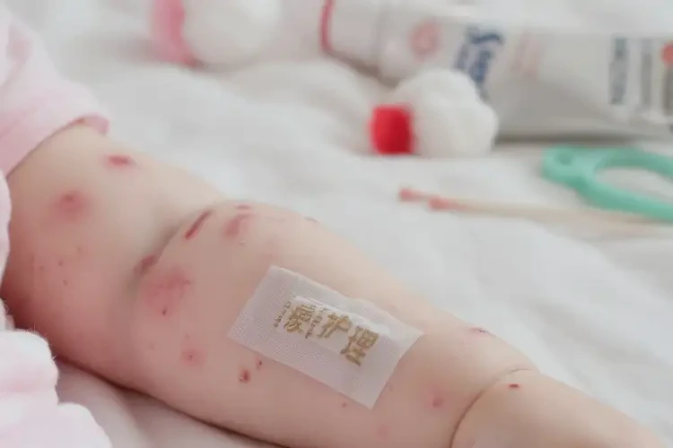 寶寶手臂上有濕疹可以治好嗎(圖4)