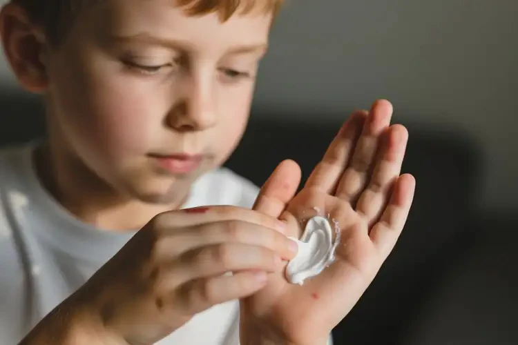 男生手上出濕疹可不可以根治(圖2)