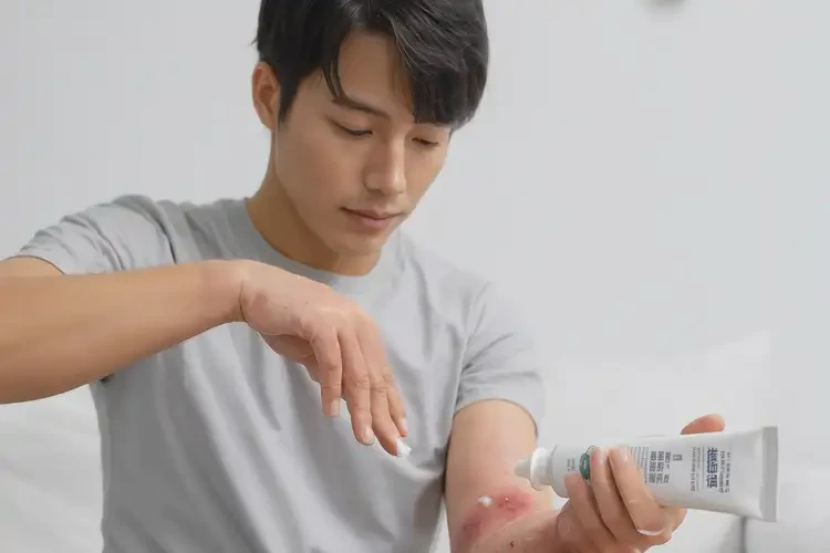 男生手臂出現(xiàn)濕疹可不可以根治(圖2)