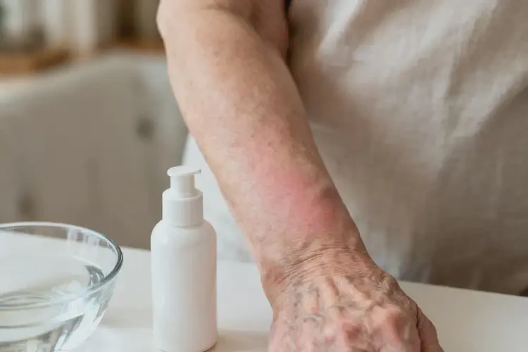 高齡老人手臂經(jīng)常長(zhǎng)濕疹能不能徹底自愈(圖1)