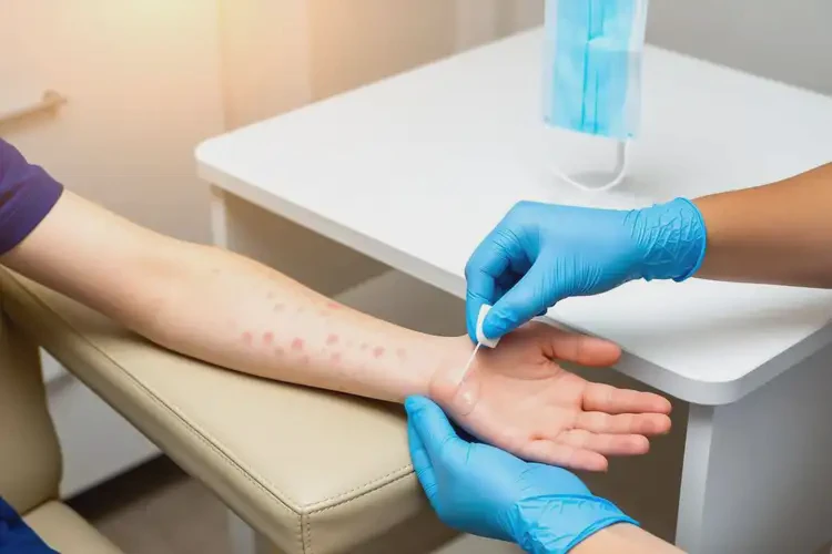 青少年手臂有濕疹可以治好嗎(圖4)