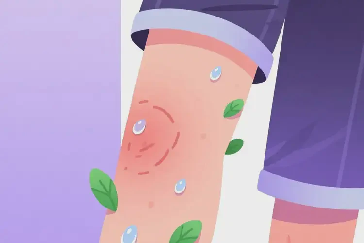 中學(xué)生大腿上偶爾起濕疹可以治好嗎(圖2)