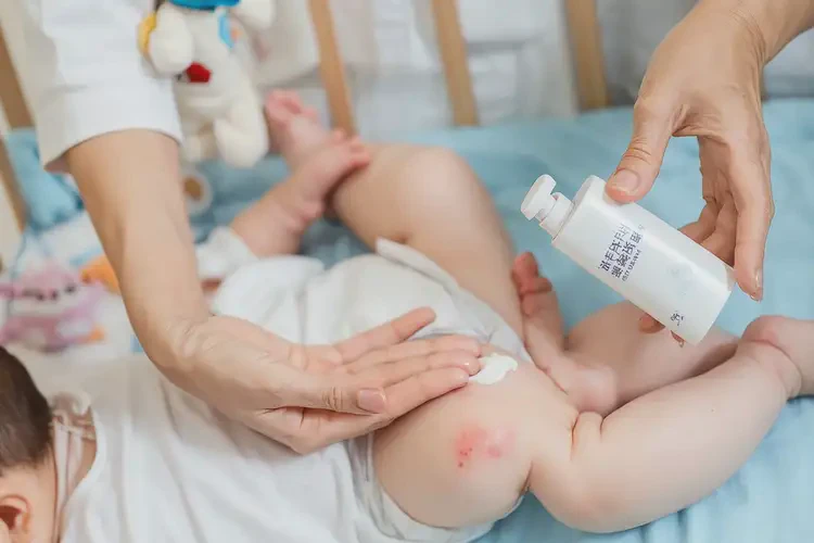 宝宝小腿有湿疹可以治好吗(图3)