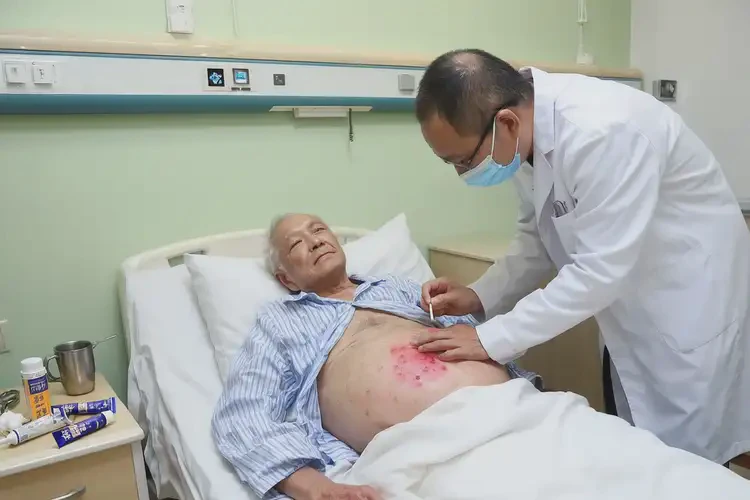 老人肚子上起濕疹可以治好嗎(圖3)