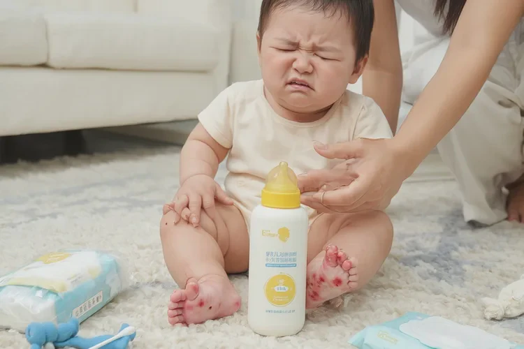 宝宝脚上容易起湿疹可以治愈吗(图1)