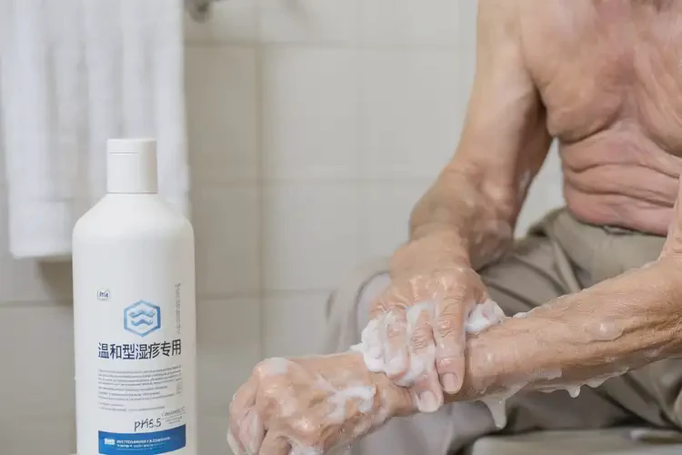 老人身上出濕疹可以治好嗎(圖3)