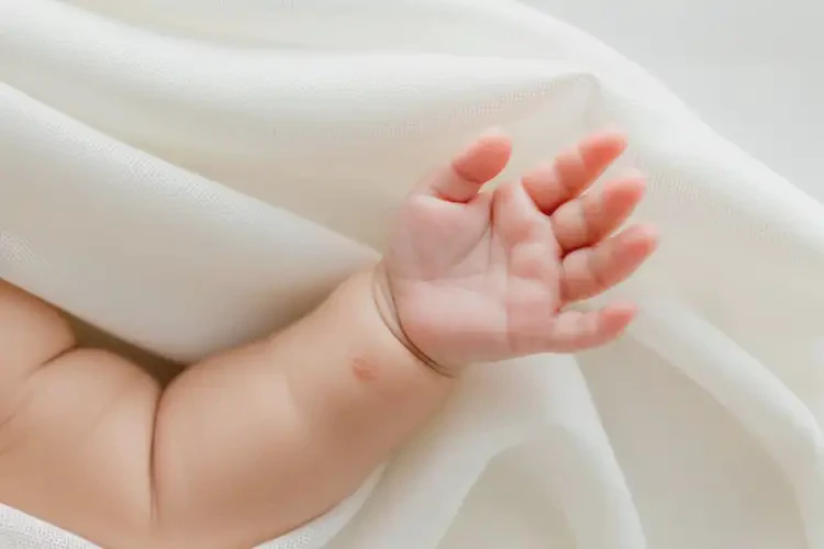 新生兒手臂上有濕疹可以治好嗎(圖2)