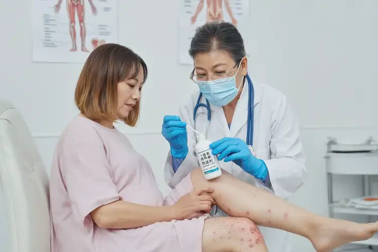 哺乳期媽媽小腿上容易長濕疹可以治好嗎(圖3)