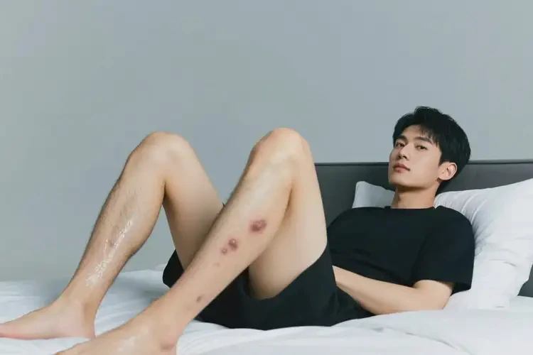 男生小腿偶爾長濕疹可以治好嗎(圖2)