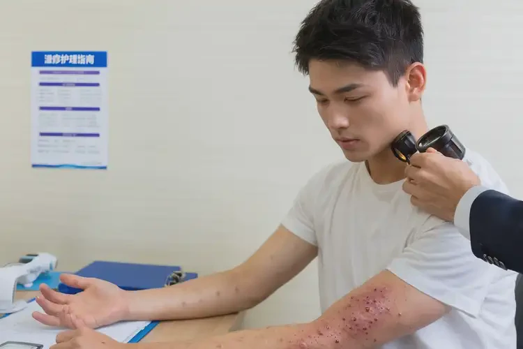 青年人身上經(jīng)常起濕疹可以治好嗎(圖4)