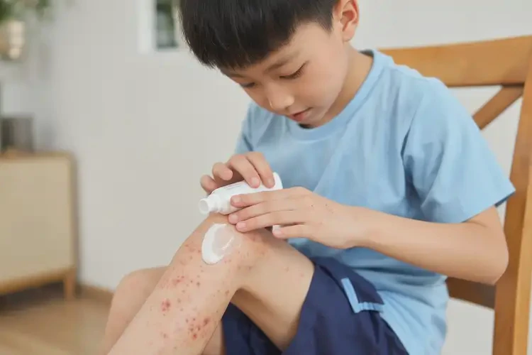 小學(xué)生大腿偶爾起濕疹可不可以根治(圖2)