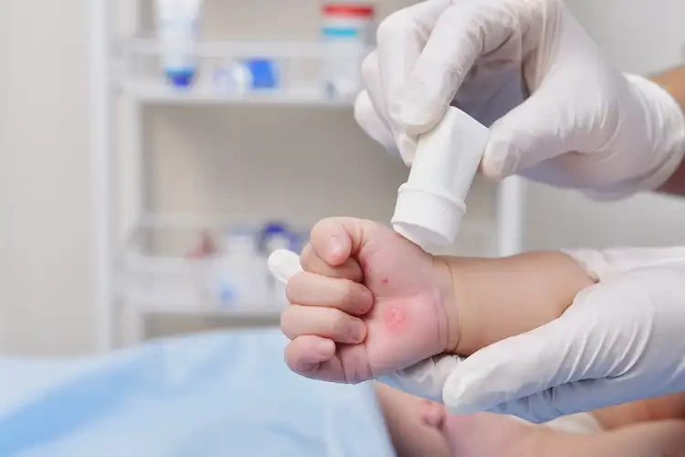 嬰兒手上有濕疹可以治好嗎(圖3)