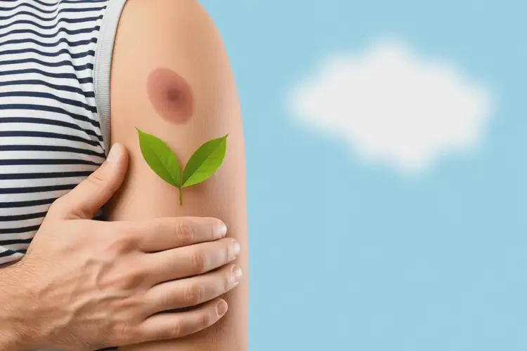 男生手臂經(jīng)常長(zhǎng)濕疹可以治好嗎(圖1)