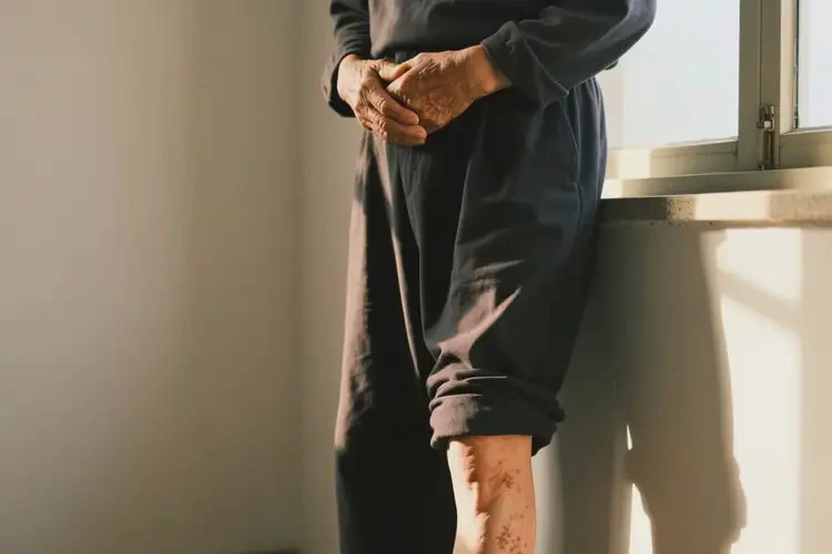 老人大腿偶爾長濕疹可以治好嗎(圖1)