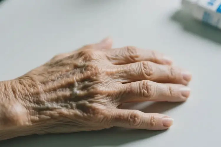 老人手上有湿疹可以治好吗(图2)