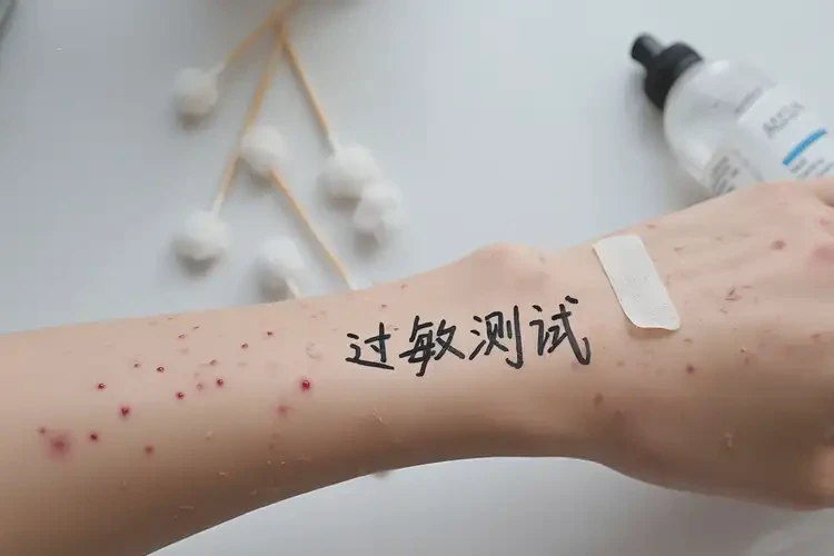 女性手上有濕疹不管它會(huì)自己痊愈嗎(圖4)