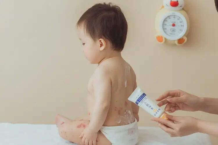 嬰幼兒屁股上經(jīng)常起濕疹可以治好嗎(圖3)