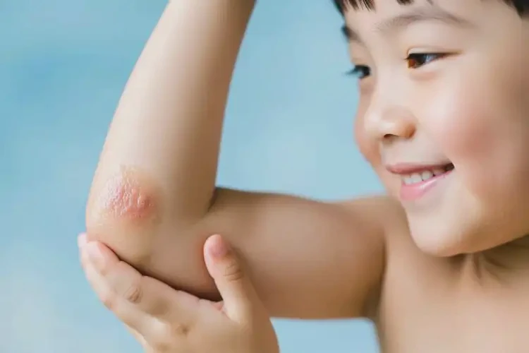 孩子手臂上出濕疹可以治好嗎(圖2)