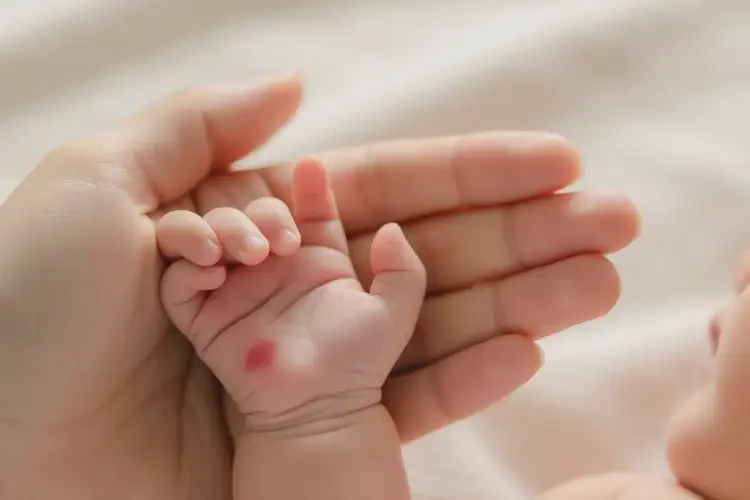 新生兒身上經(jīng)常起濕疹可以治好嗎(圖1)