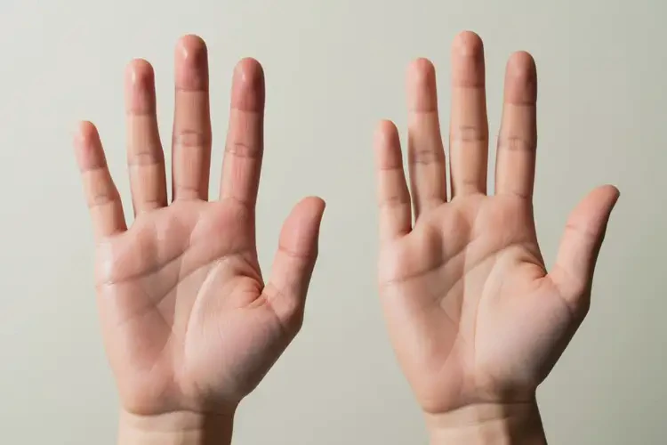 大學生手上長濕疹可以治好嗎(圖2)