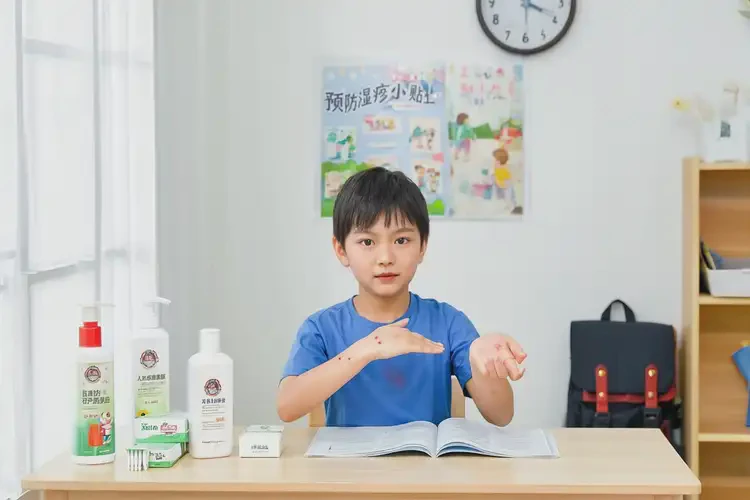 小學(xué)生手上偶爾長濕疹可不可以根治(圖2)