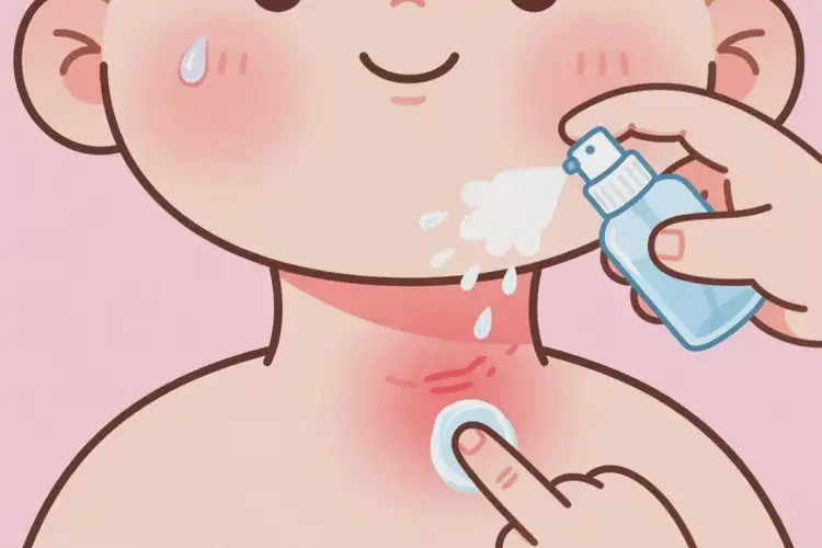 宝宝脖子经常长湿疹可以治好吗(图3)