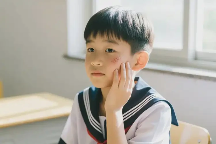 中學(xué)生臉上偶爾起濕疹可以治好嗎(圖4)